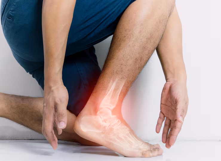 Ankle Fracture Treatment in Malleswaram