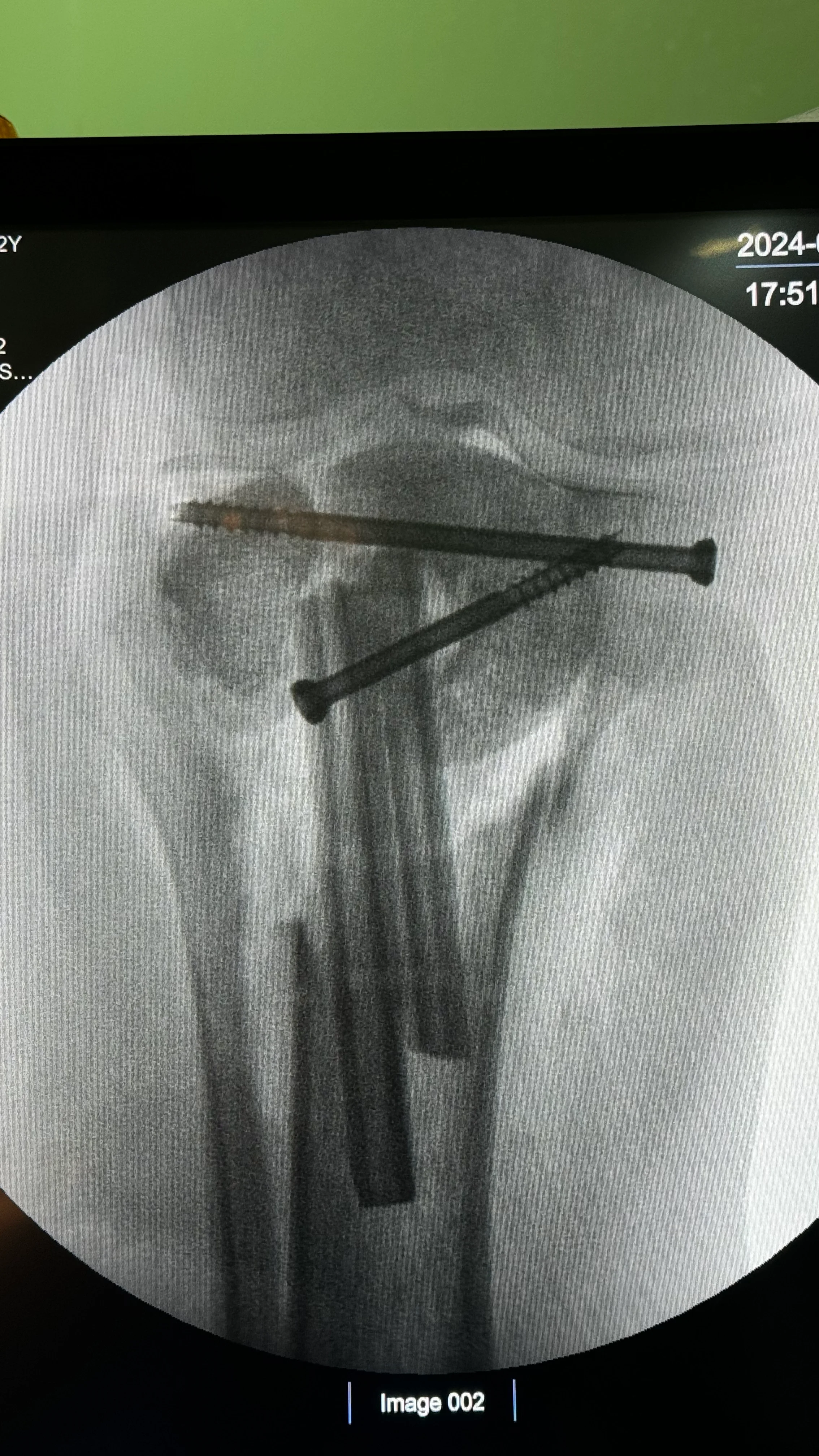Hospital 1