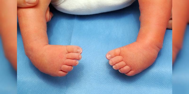Paediatric Orthopaedics in Malleswaram