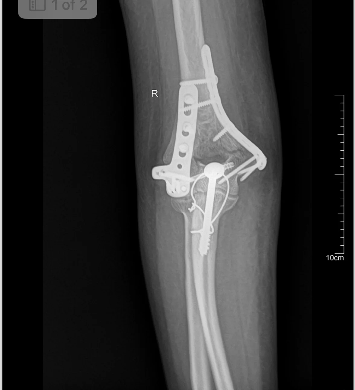 Hospital 1