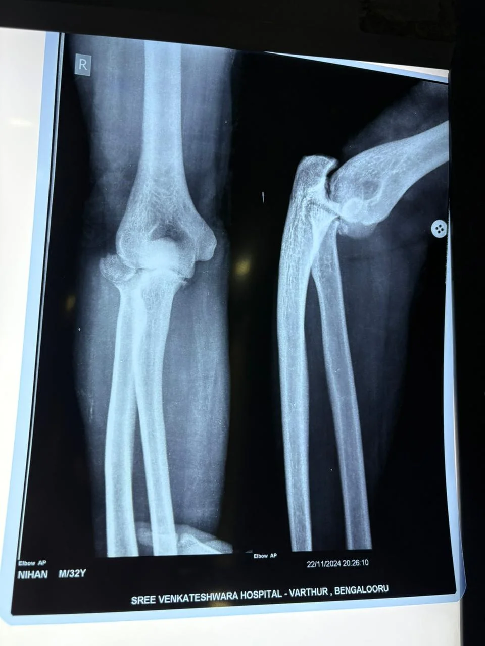 Hospital 1