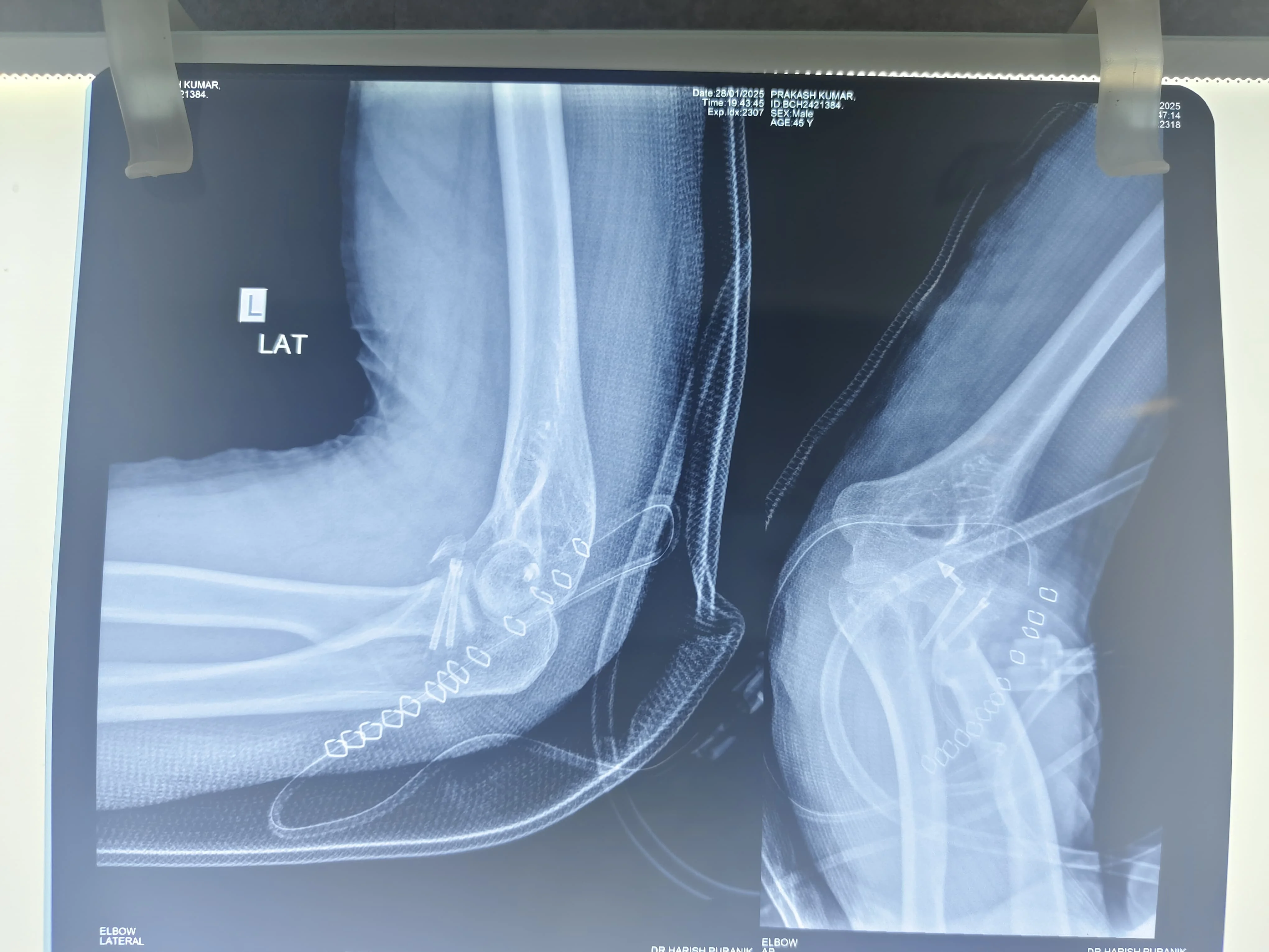 Hospital 1