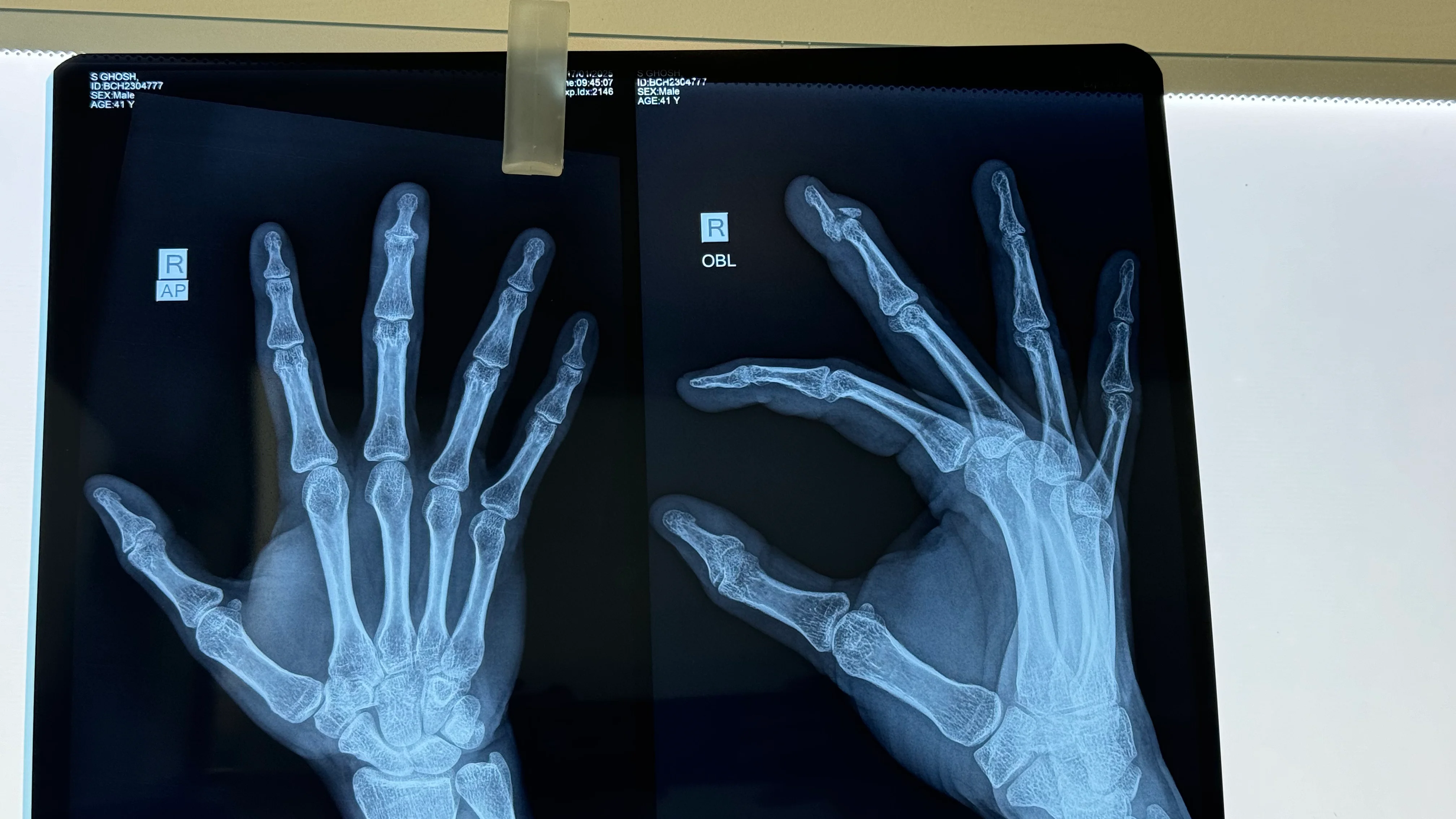 Hospital 1