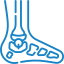 Tendinopathies