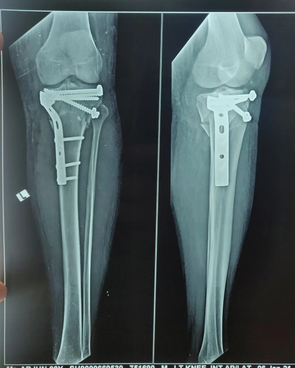 Hospital 1